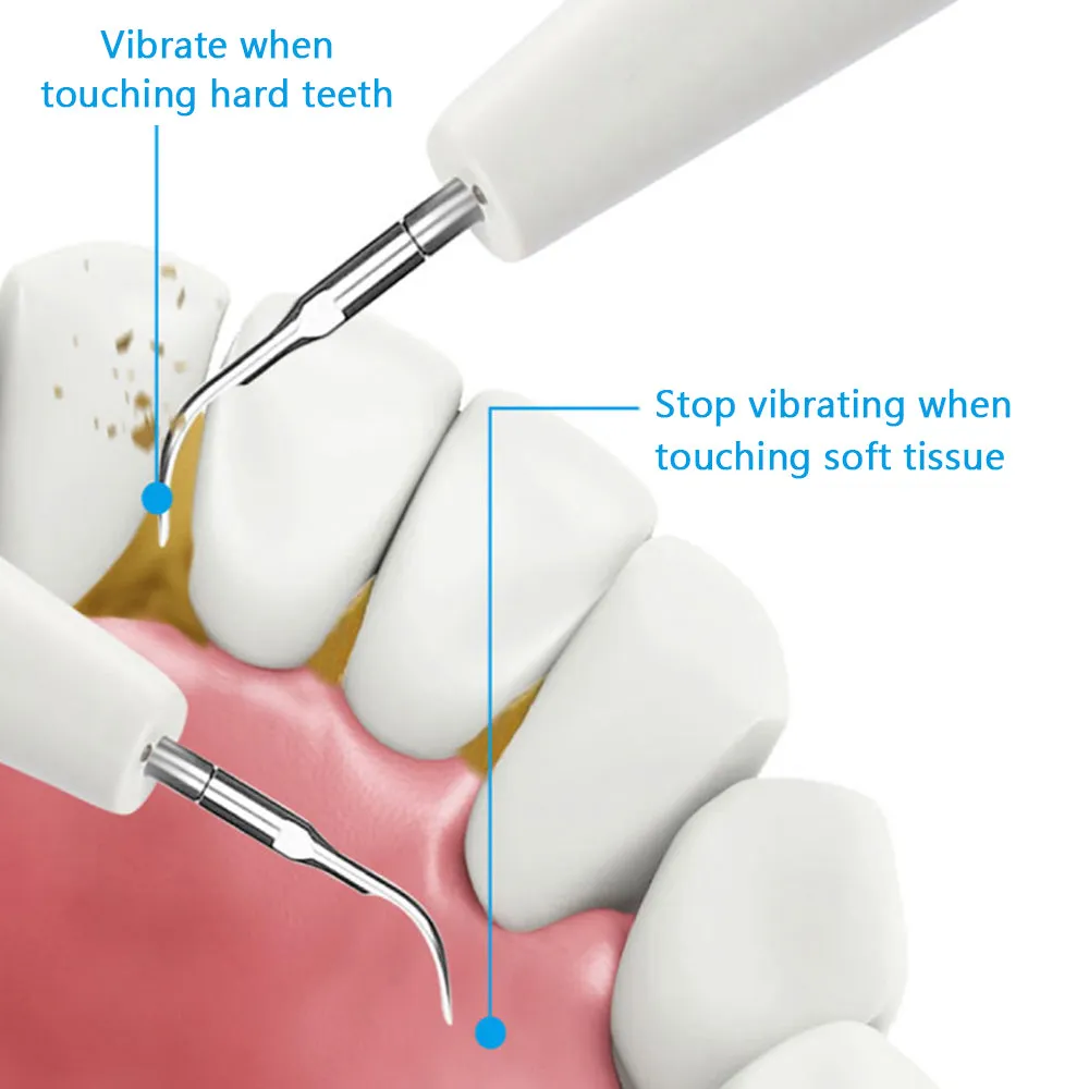 Electric Dental Calculus Remover